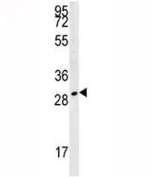 TPSAB1 Antibody - image 1