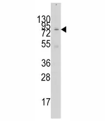 GCN5 Antibody - image 1