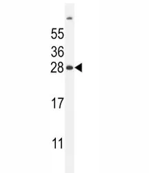 FAT10 Antibody - image 1