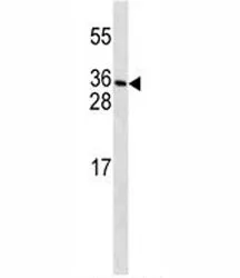 PDGFC Antibody - image 1