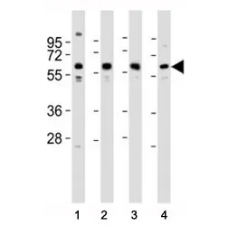 Pyruvate Kinase Antibody / PKM2 - image 1