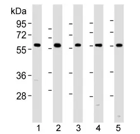 Pyruvate Kinase Antibody / PKM2 - image 1