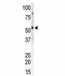 CAMK2 gamma Antibody (CAMK2G) - image 1