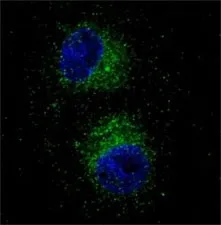 MET Antibody (HGFR) - image 1