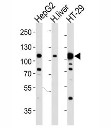 MET Antibody (HGFR) - image 1