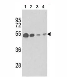 b-Tubulin Antibody - image 1