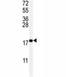 UBC9 Antibody - image 1