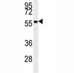 AKT2 Antibody - image 1