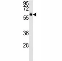 AKT3 Antibody - image 1