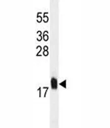 MCFD2 Antibody - image 1