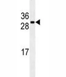 CDCA8 Antibody - image 1