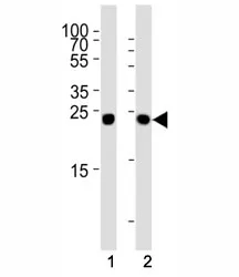 Glucagon Antibody - image 1