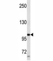 Progesterone Receptor Antibody - image 1