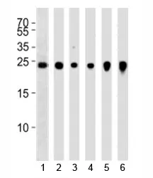 UCHL1 Antibody - image 1