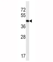 Skeletal Muscle Actin Antibody - image 1