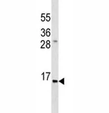 Insulin Antibody - image 1