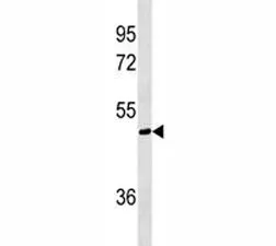 AKT1S1 Antibody / PRAS40 - image 1