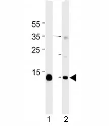 Myoglobin Antibody - image 1