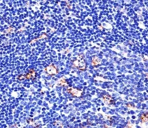 Integrin beta 2 Antibody (ITGB2) - image 1