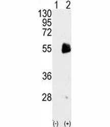 PRMT7 Antibody - image 1