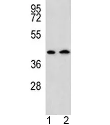 AADAT Antibody - image 1