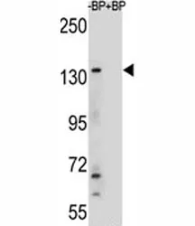 JMJD3 Antibody - image 1
