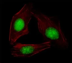 SREBP2 Antibody (SREBF2) - image 1