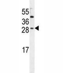 IGF2 Antibody - image 1