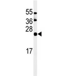 ISG15 Antibody - image 1