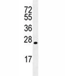 LIN28 Antibody - image 1