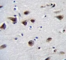 MeCP2 Antibody - image 1