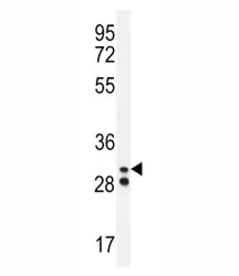 Neutrophil elastase Antibody - image 1