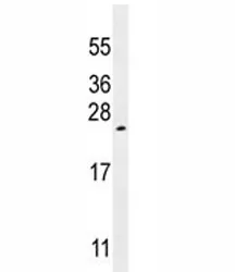 VEGF-A Antibody - image 1