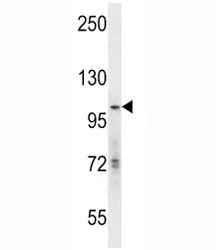 GCN5 Antibody - image 1
