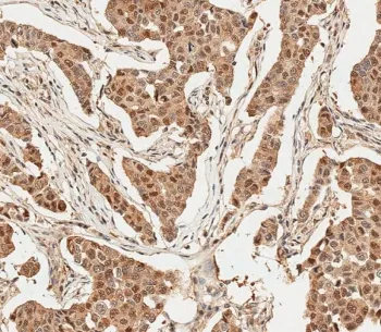 Ubiquitin Antibody - image 1