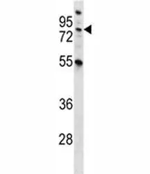 MST1 Antibody (Hepatocyte growth factor-like protein) - image 1
