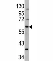 MDM2 Antibody - image 1