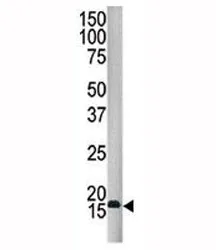 SUMO4 Antibody - image 1