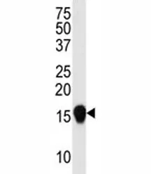 SUMO4 Antibody (V55 Mutant) - image 1