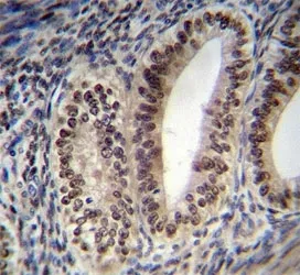 Progesterone Receptor Antibody - image 1