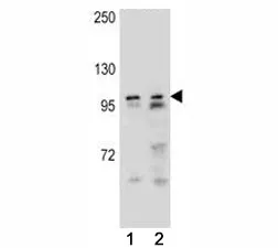 Androgen Receptor Antibody - image 1