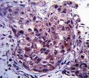 Estrogen Receptor Antibody - image 1