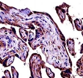 C9 Antibody (Complement 9) - image 1