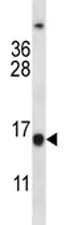 BCL2 Antibody - image 1