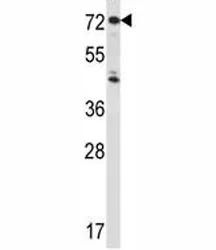 IL-1 Receptor type 1 Antibody - image 1