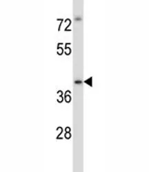 Irak4 Antibody - image 1