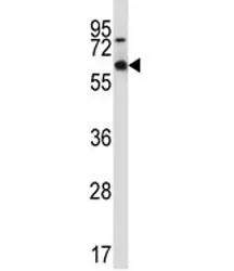 MEF2D Antibody - image 1