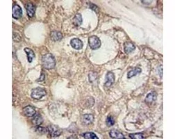 AFP Antibody (Alpha Fetoprotein) - image 1