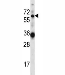 GATAD2B Antibody (p66 beta) - image 1