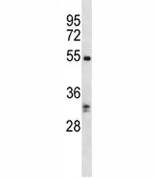 RIPK3 Antibody - image 1